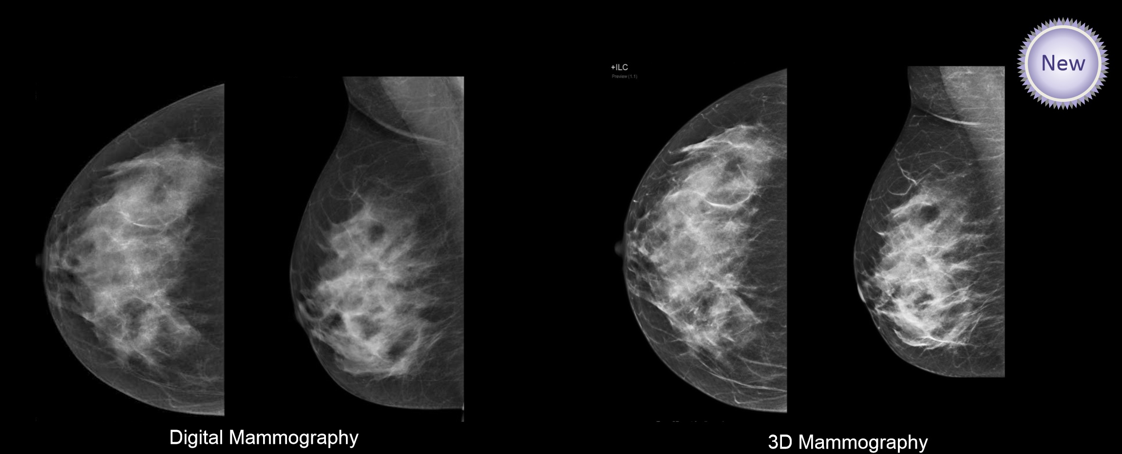 3d mammo clinical