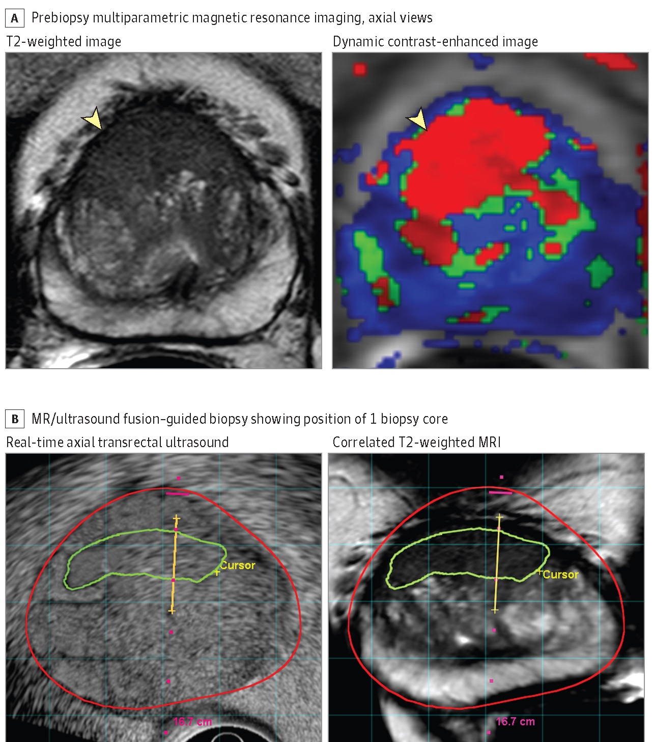 biopsy clinical