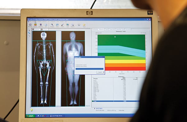 bone-density-scan