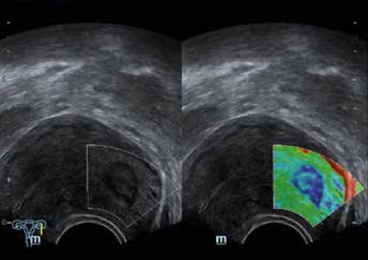 us mindray clinical